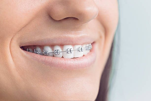 Best Wisdom Tooth Removal  in Placentia, CA